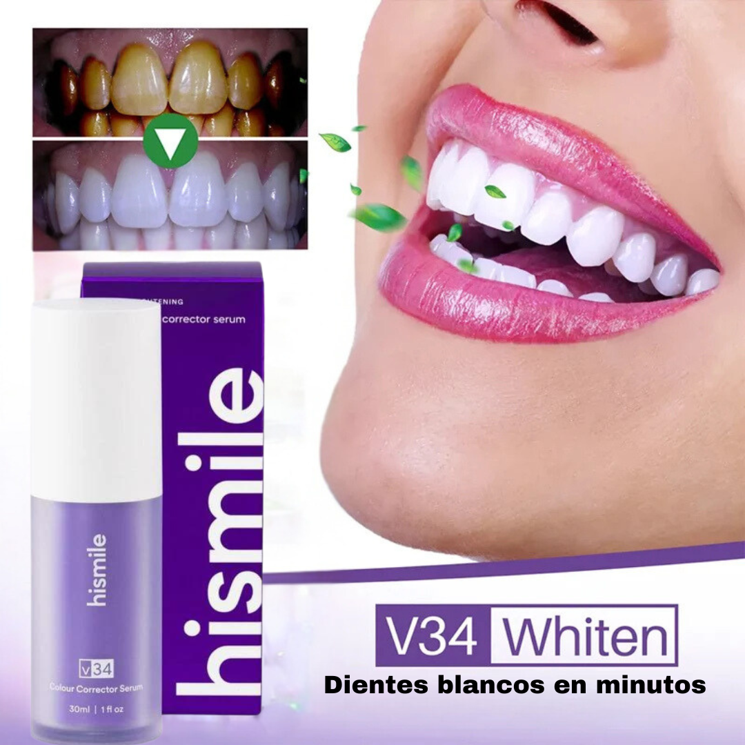 Smilekit Branqueador